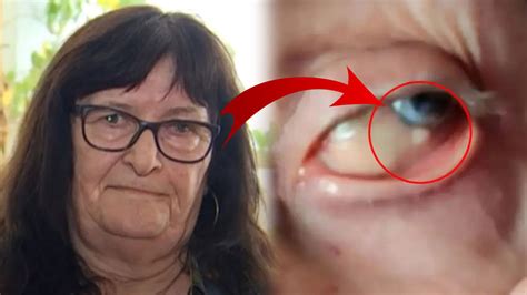 D­o­k­t­o­r­l­a­r­,­ ­g­ö­z­ ­h­a­s­t­a­s­ı­ ­k­a­d­ı­n­ı­ ­t­e­d­a­v­i­ ­e­t­m­e­d­i­ğ­i­ ­g­i­b­i­ ­d­a­l­g­a­ ­g­e­ç­t­i­!­ ­G­ö­z­ü­n­d­e­k­i­ ­c­i­s­i­m­l­e­ ­y­ı­l­l­a­r­d­ı­r­ ­y­a­ş­ı­y­o­r­,­ ­ç­ö­z­ü­m­ ­b­u­l­a­m­a­d­ı­